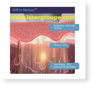 قیمت ویژه دستگاه لیزر سوپرانو